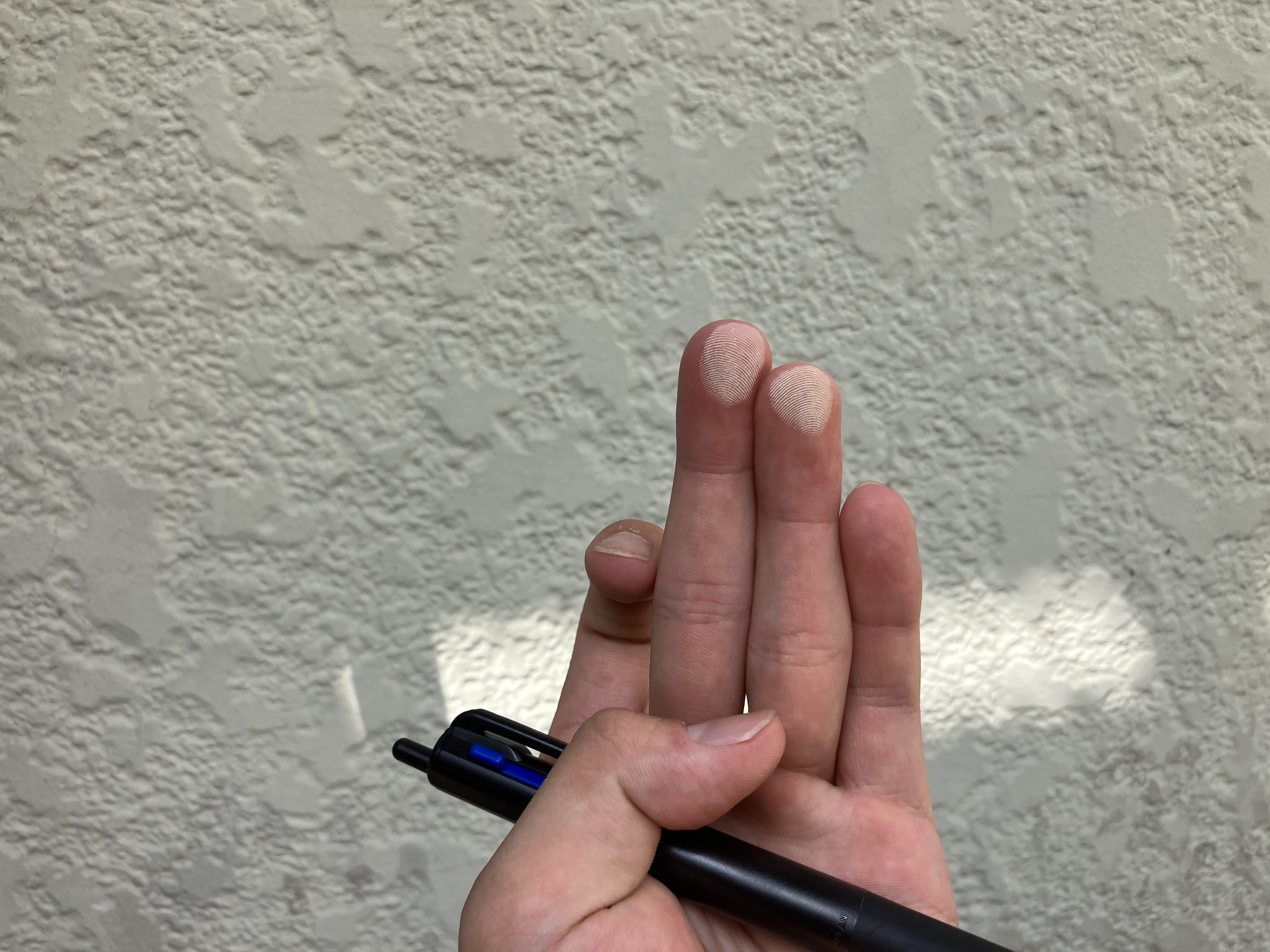 外壁を触ると手が白くなる！？それ、チョーキング現象かも！